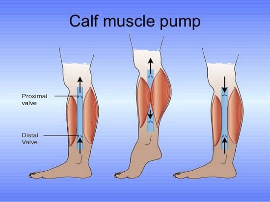 عملکرد سه گانه پمپ عضلات پا در مرجع مدیریت زخم